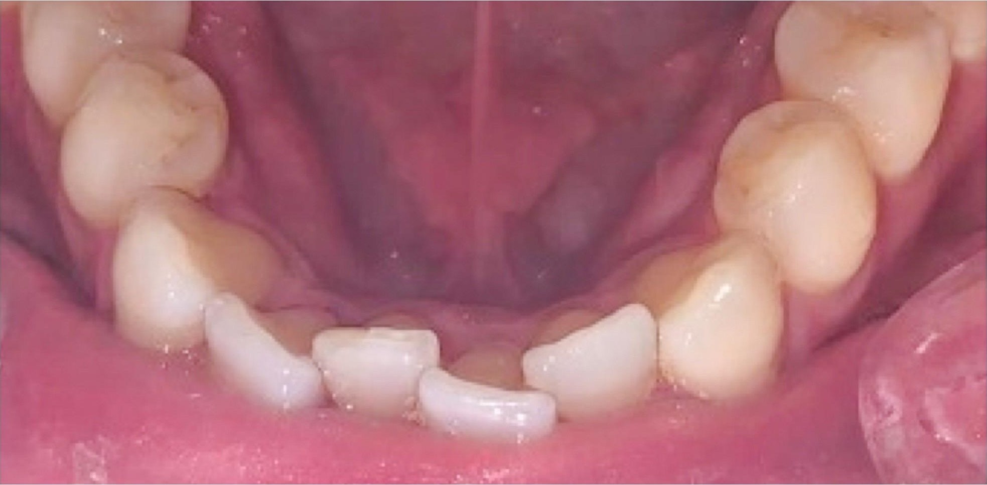 1-a