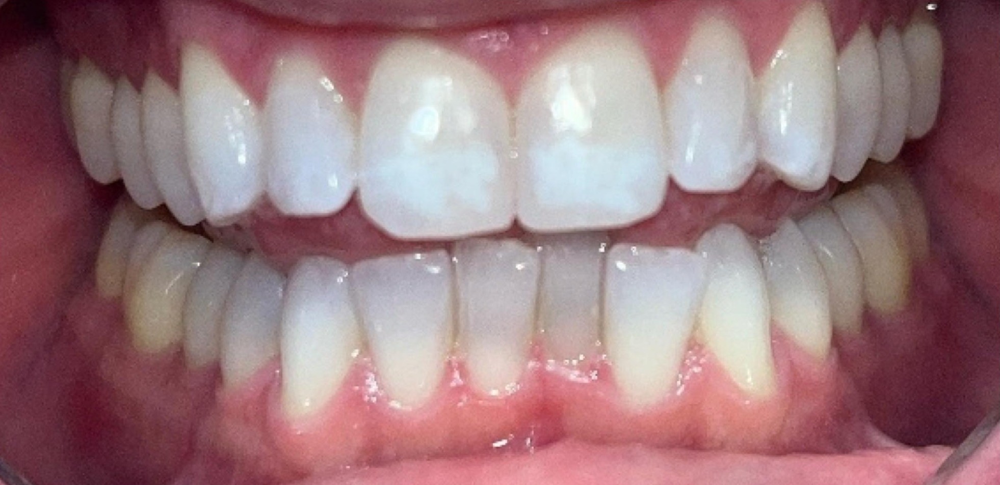 7-a
